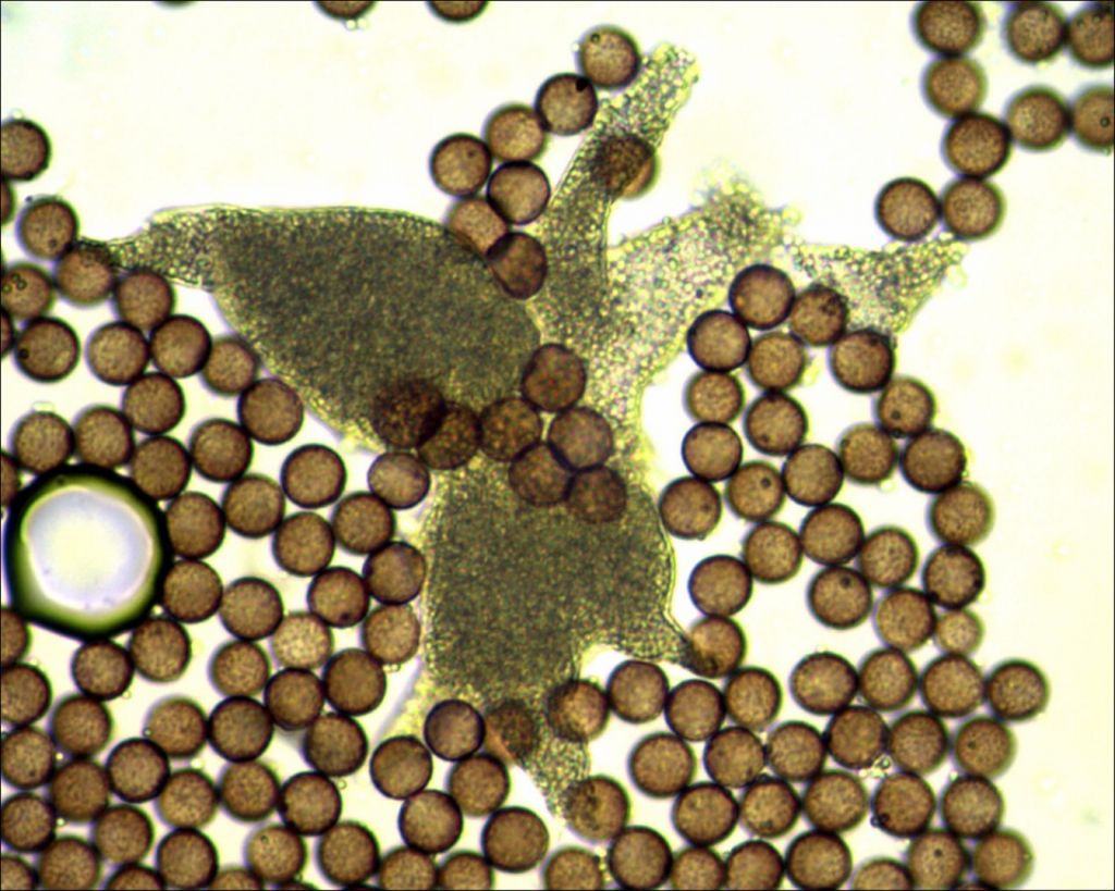 Badhamia or Physarum?